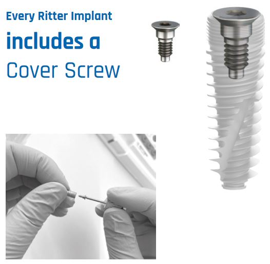 The Ritter Implant Screw